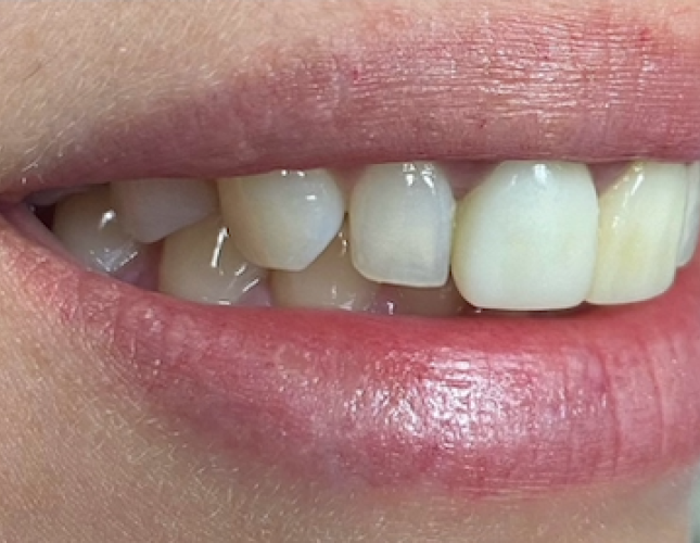 Nadia before