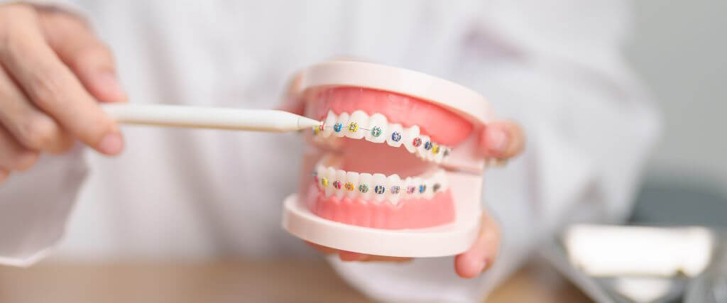 Transform Your Smile: A Comprehensive Look at Orthodontic Care